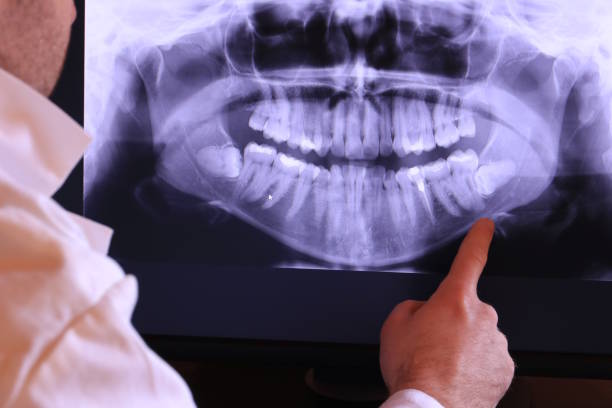 Best Broken or Cracked Tooth Emergency Dentist in Crandall, TX