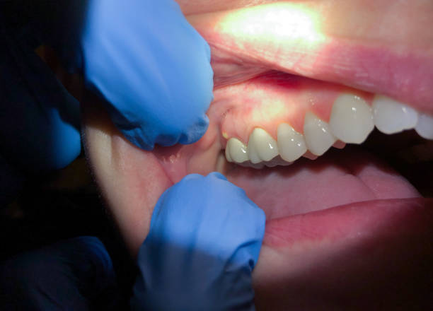 Best Urgent Dental Care for Toothache in Crandall, TX